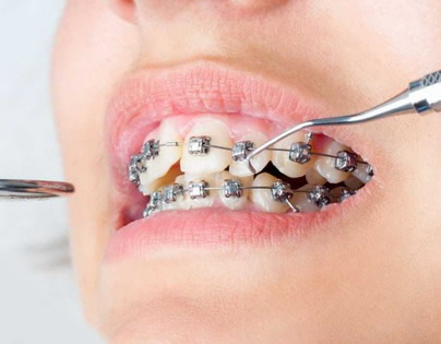 Jeigu norite, kad ortodontinis gydymas būtų sėkmingas